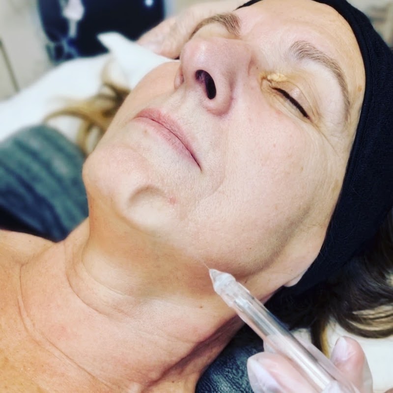 Derm'A soins - Expert de la peau et silhouette - Jet Peel