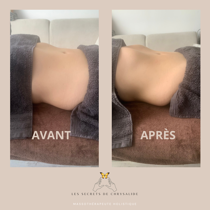 Stéphanie Bouvier Drainage lymphatique Renata França–Soins et Massages énergétiques-Herblay (95)